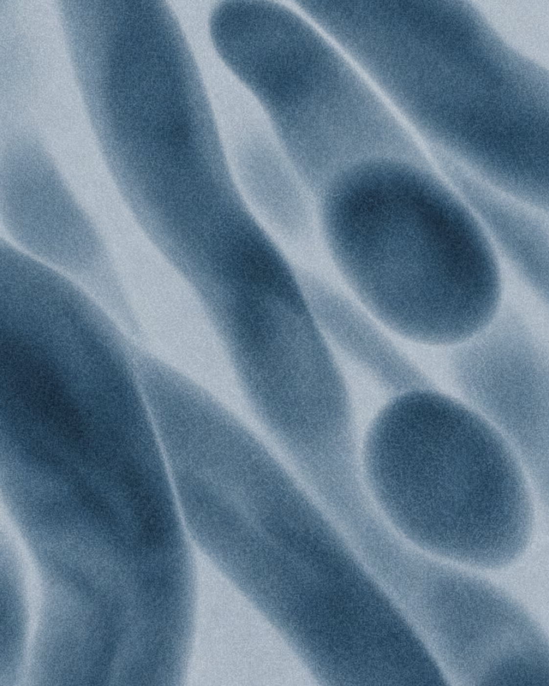 Creatine Kinase